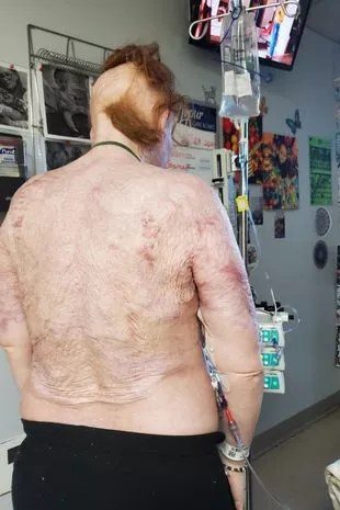 “我在街上被陌生人活活烧死，但活了下来，看到正义得到伸张”