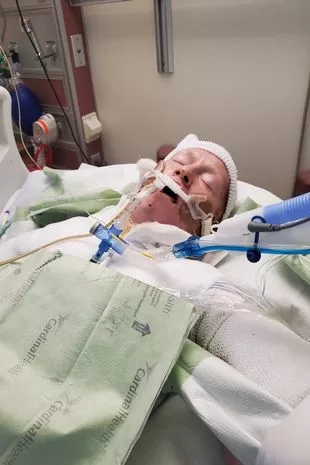 “我在街上被陌生人活活烧死,但活了下来,看到正义得到伸张”