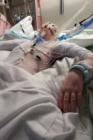 “我在街上被陌生人活活烧死,但活了下来,看到正义得到伸张”